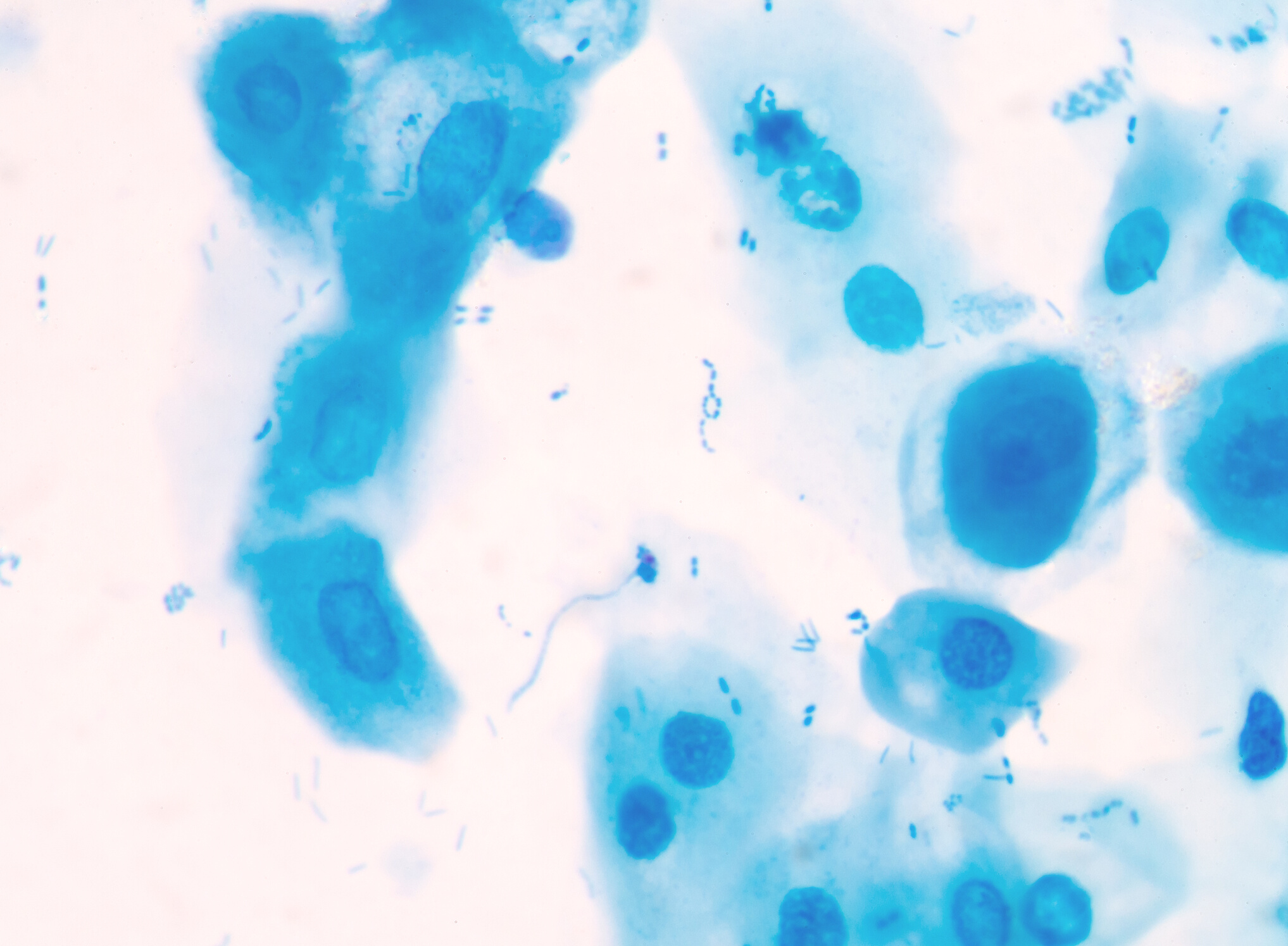 blue bacteria.